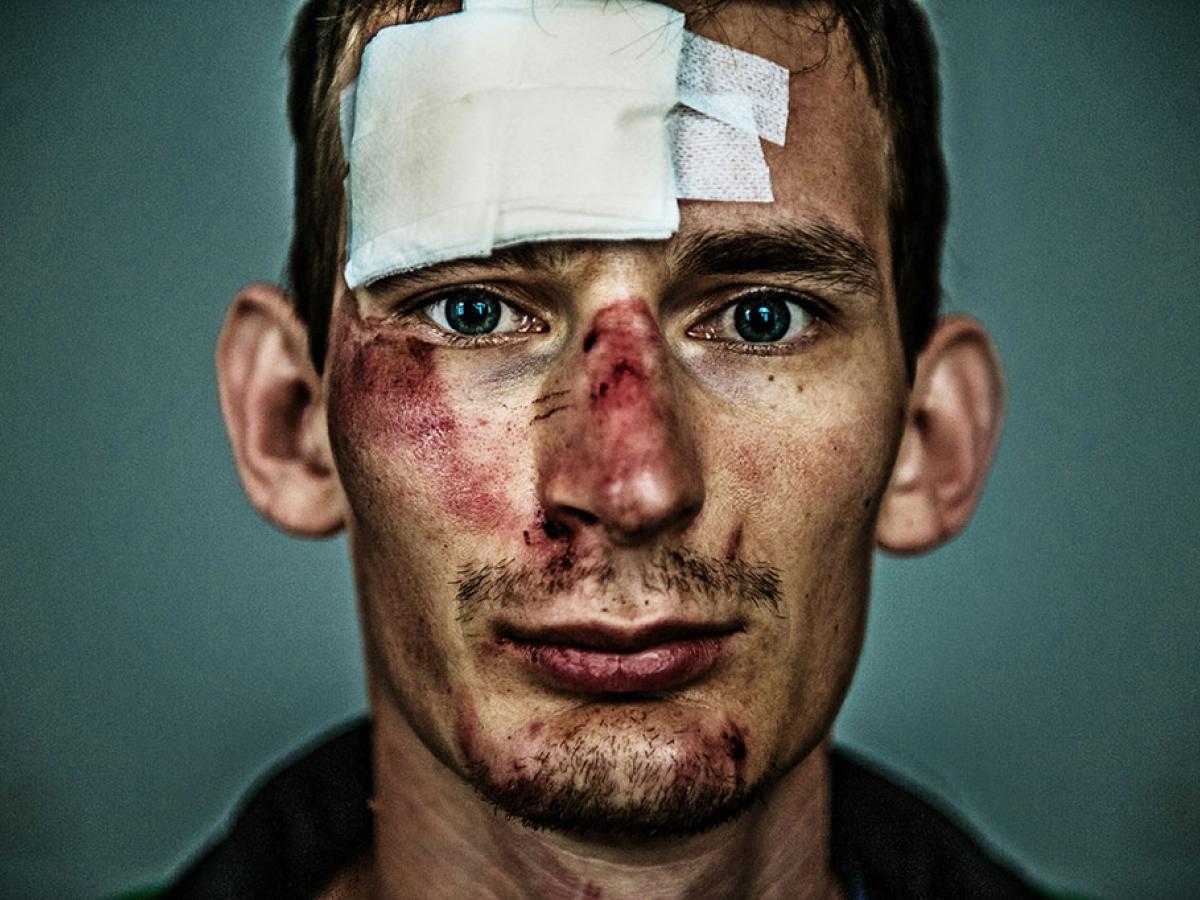 A close up of the face of a bruised and bloodied cyclist with a large bandage on his forehead.